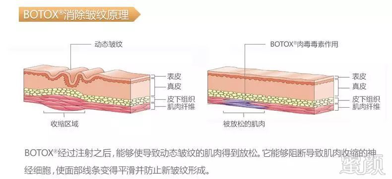 案例图片