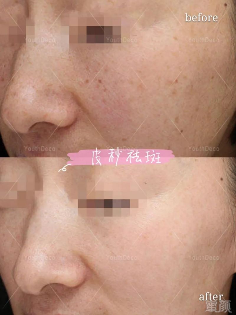 https://img.miyanlife.com/mnt/timg/190201/132J91b9-10.jpg