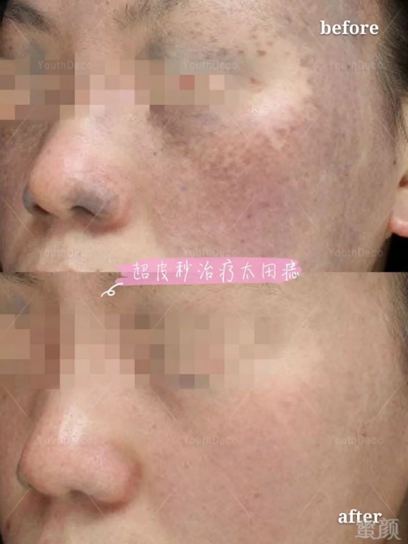 https://img.miyanlife.com/mnt/timg/190201/132K01A0-11.jpg