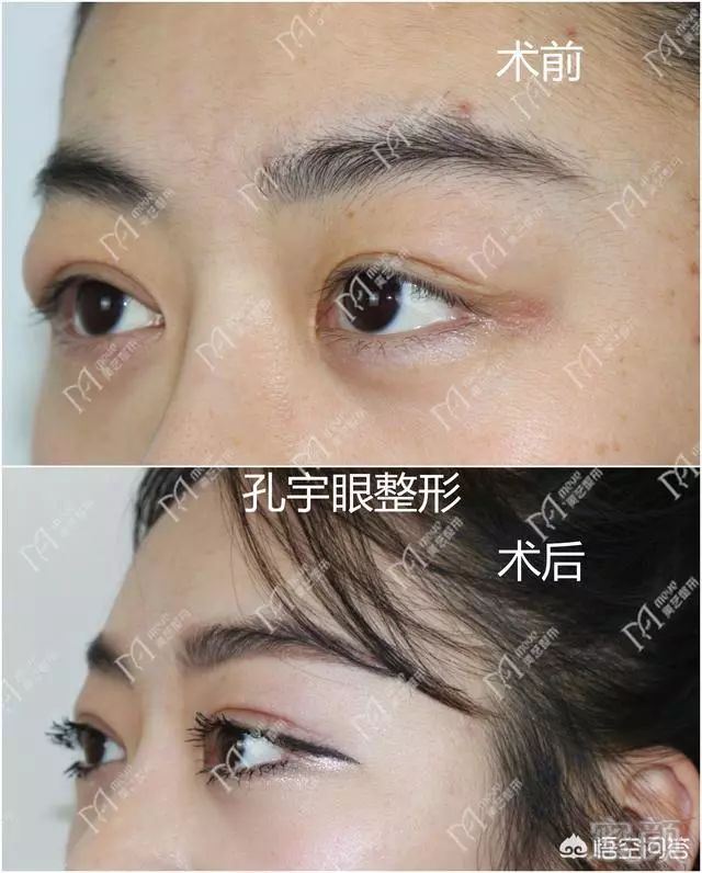https://img.miyanlife.com/mnt/timg/190201/1333036035-3.jpg