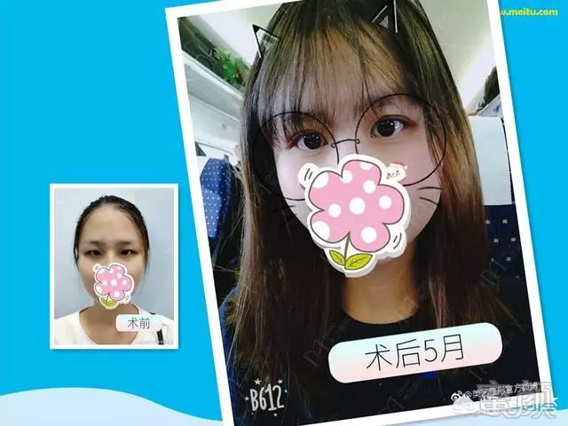 https://img.miyanlife.com/mnt/timg/190201/1333043F6-5.jpg