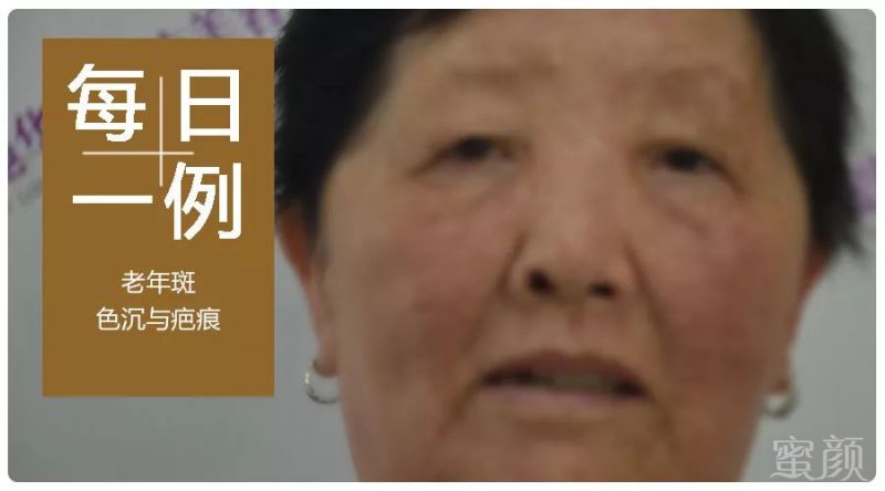 https://img.miyanlife.com/mnt/timg/190202/1154213N5-0.jpg