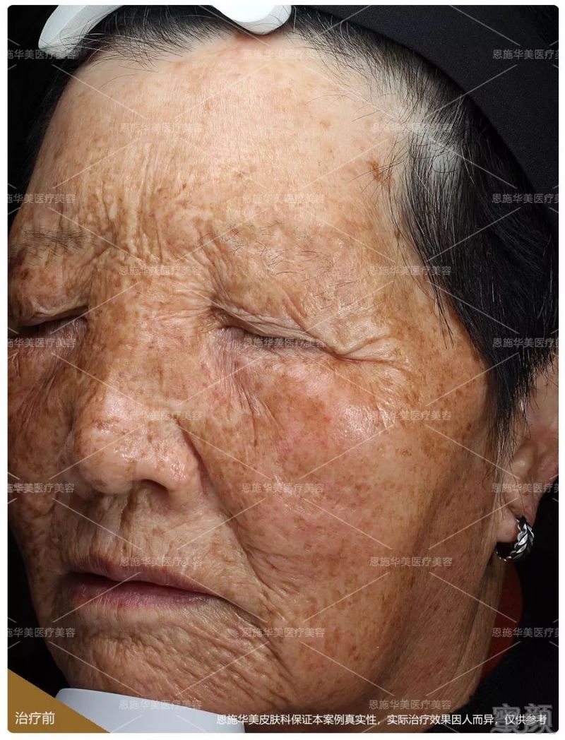 https://img.miyanlife.com/mnt/timg/190202/1154215M5-2.jpg