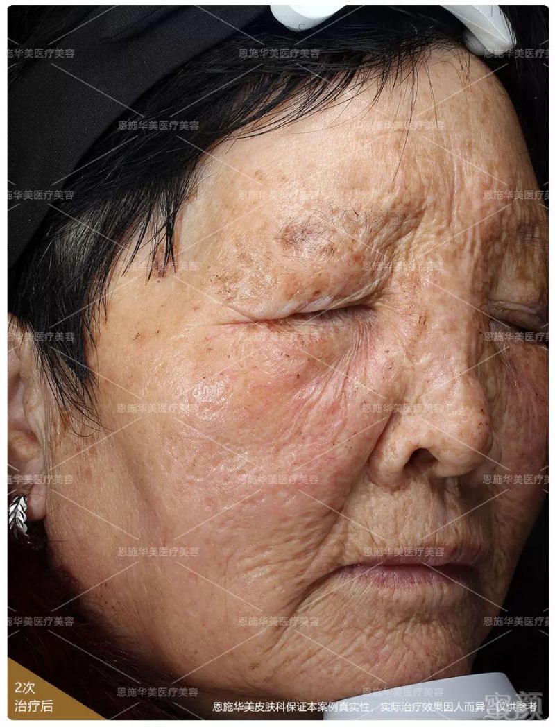 https://img.miyanlife.com/mnt/timg/190202/11542250Q-5.jpg