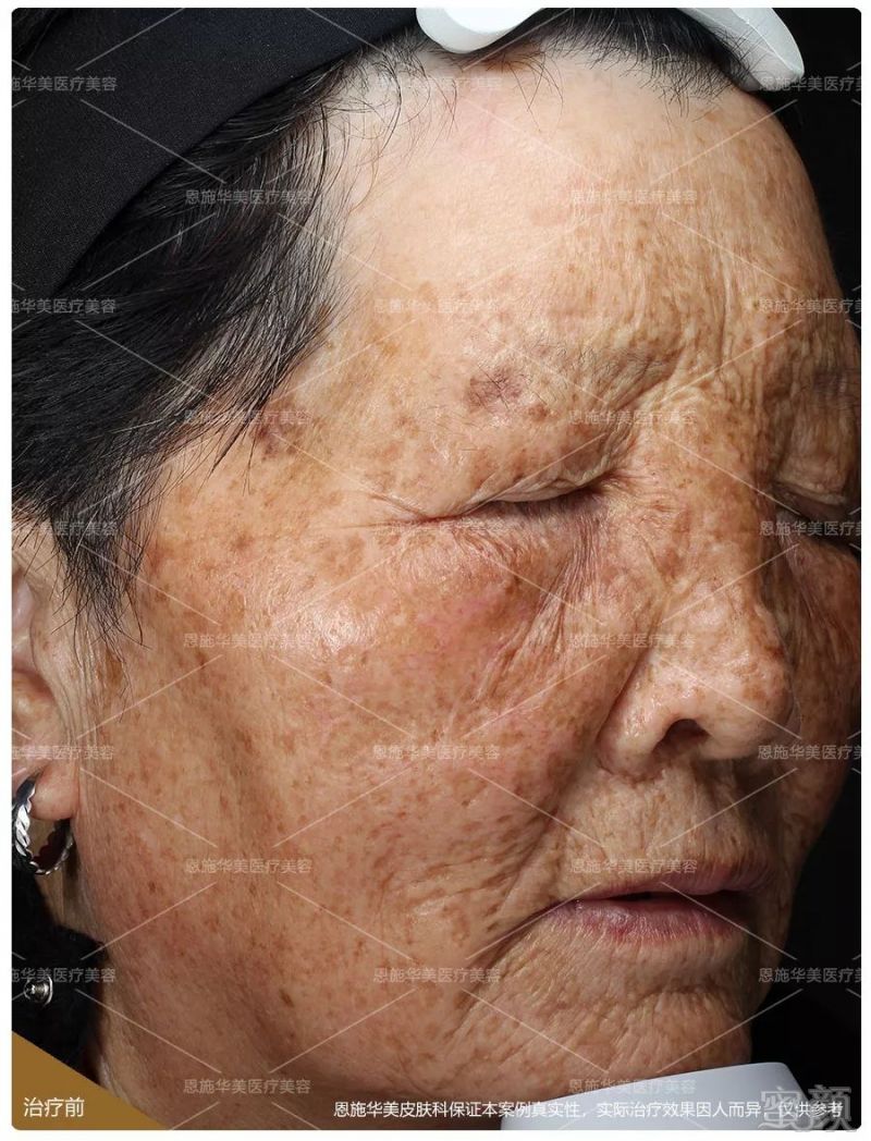 https://img.miyanlife.com/mnt/timg/190202/1154226014-3.jpg