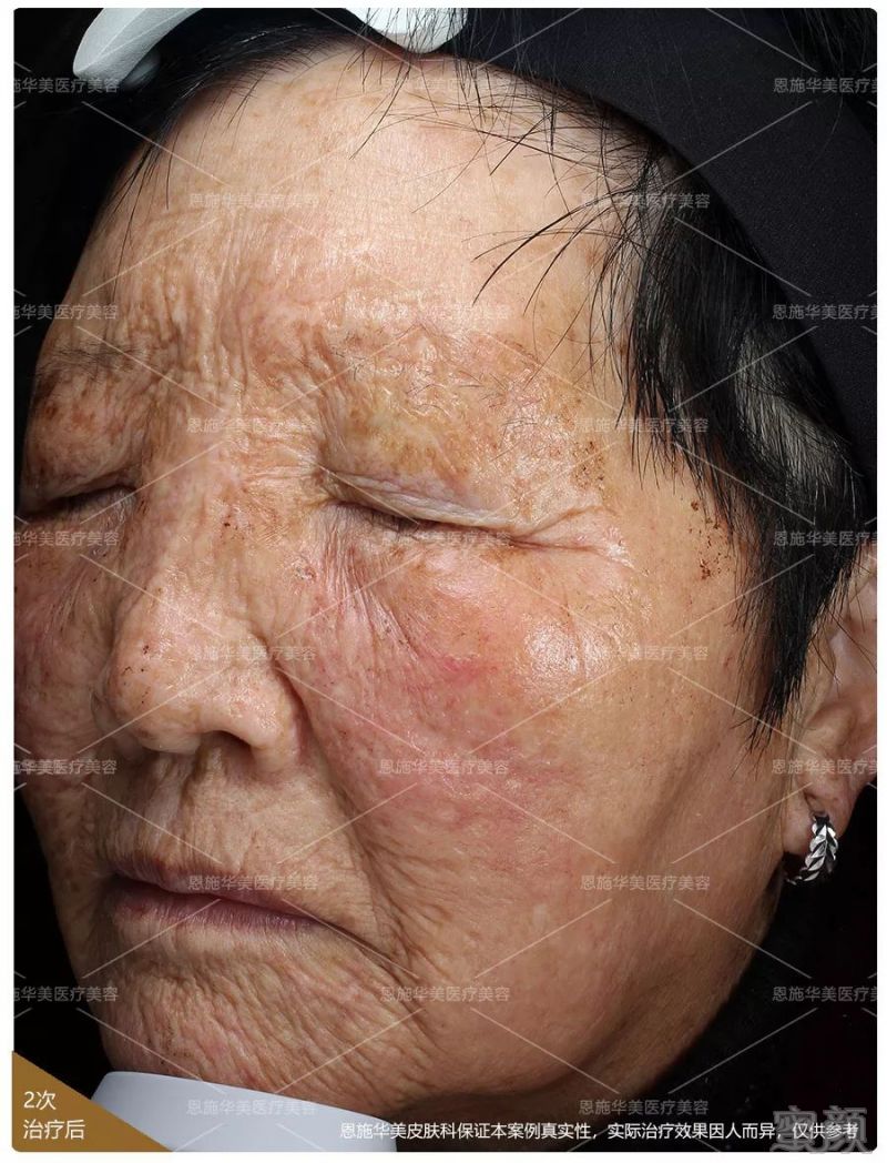 https://img.miyanlife.com/mnt/timg/190202/115423D34-6.jpg