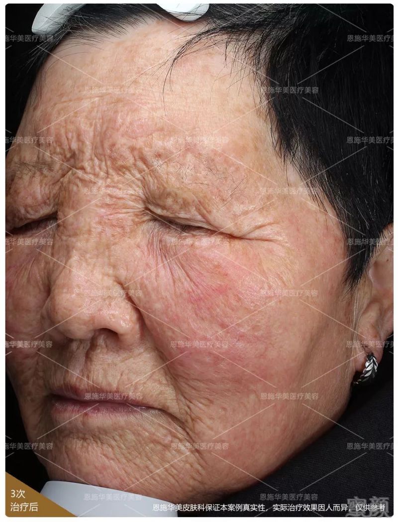 https://img.miyanlife.com/mnt/timg/190202/115423I60-7.jpg