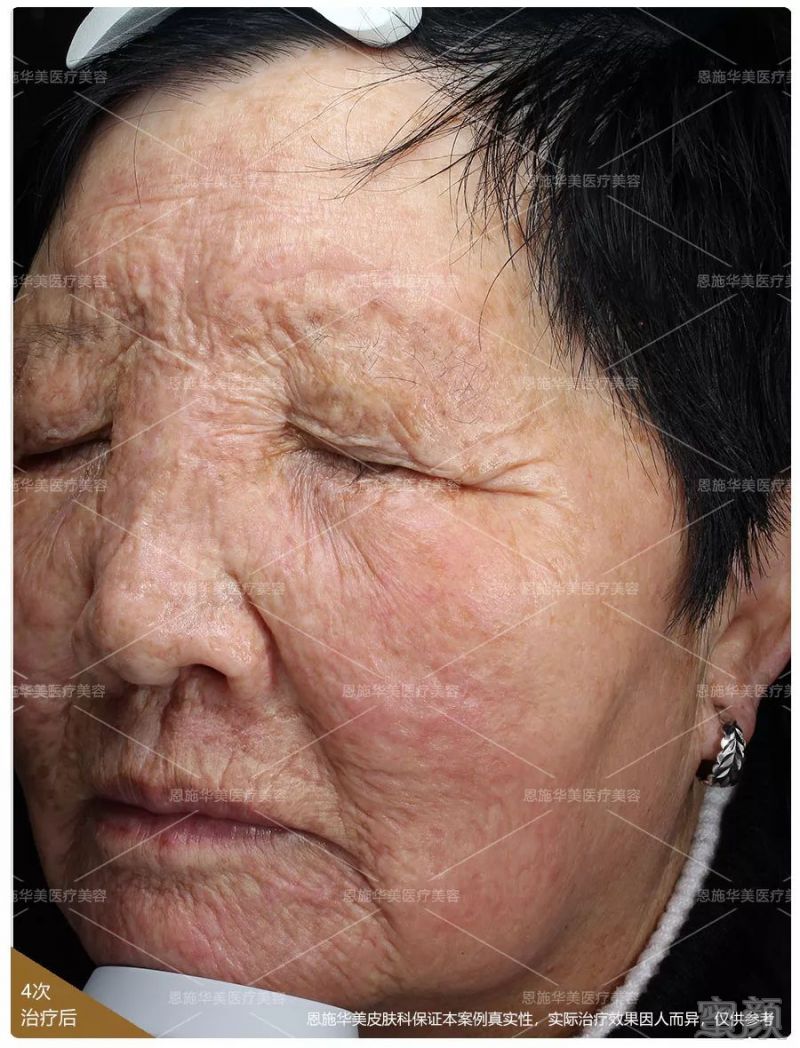https://img.miyanlife.com/mnt/timg/190202/1154241050-11.jpg