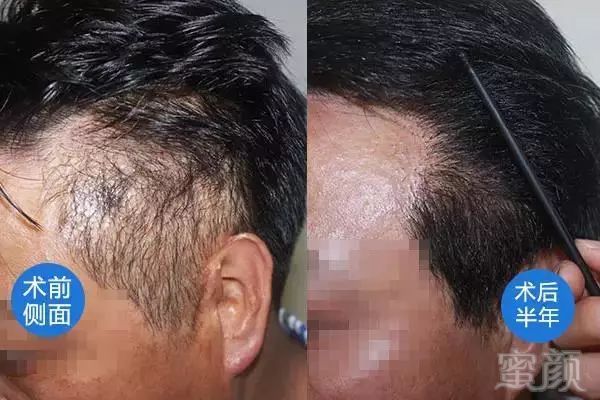 https://img.miyanlife.com/mnt/timg/190202/121J01217-7.jpg