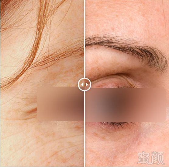 https://img.miyanlife.com/mnt/timg/190202/1222253E1-11.jpg