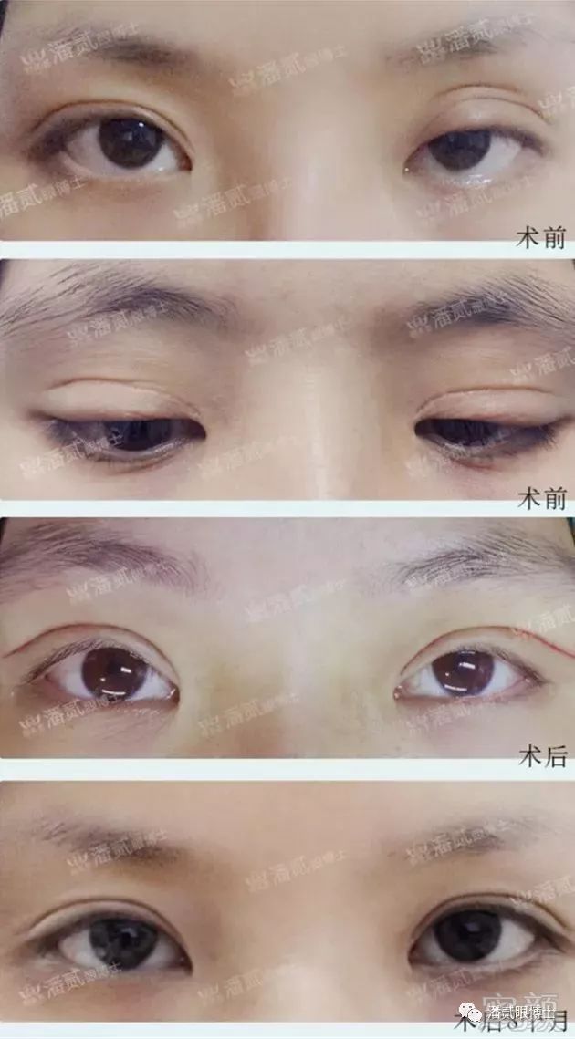 https://img.miyanlife.com/mnt/timg/190202/1232214318-3.jpg