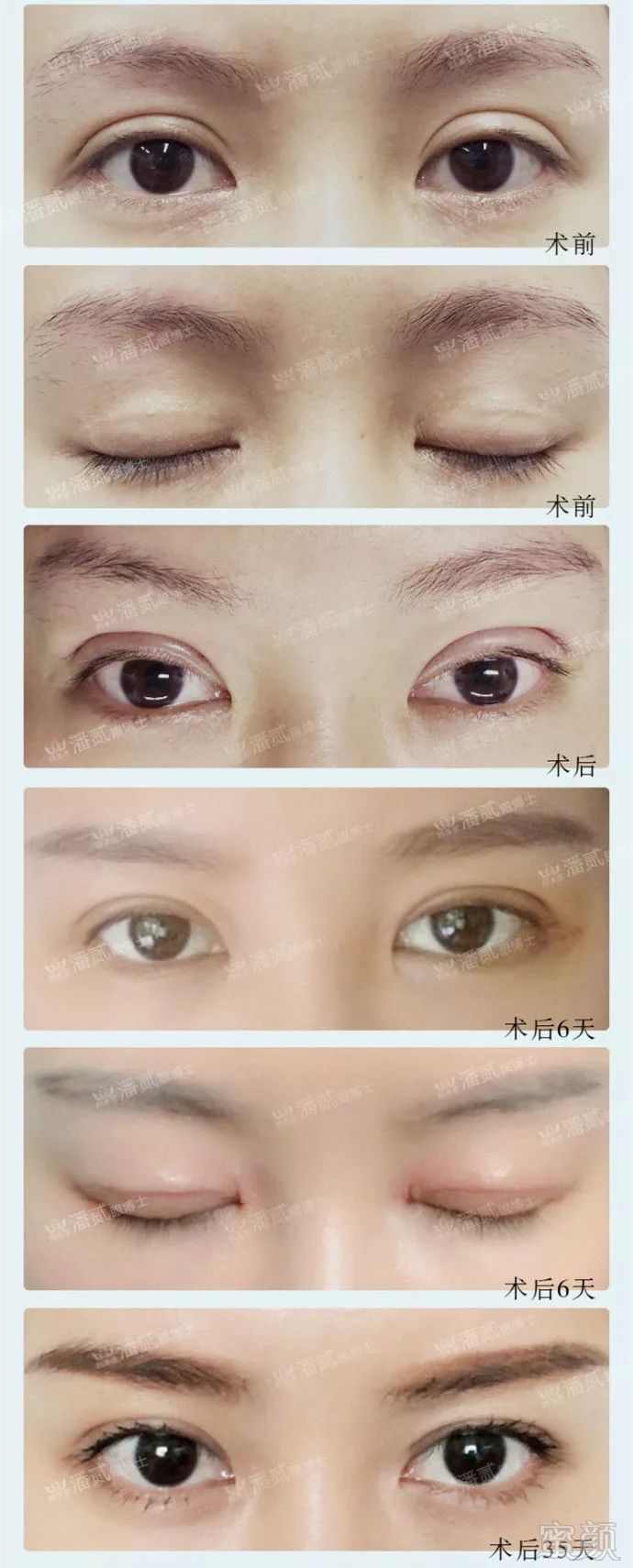 https://img.miyanlife.com/mnt/timg/190202/1232215337-2.jpg