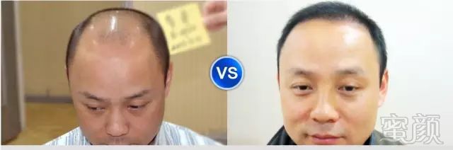 https://img.miyanlife.com/mnt/timg/190202/13154V394-1.jpg