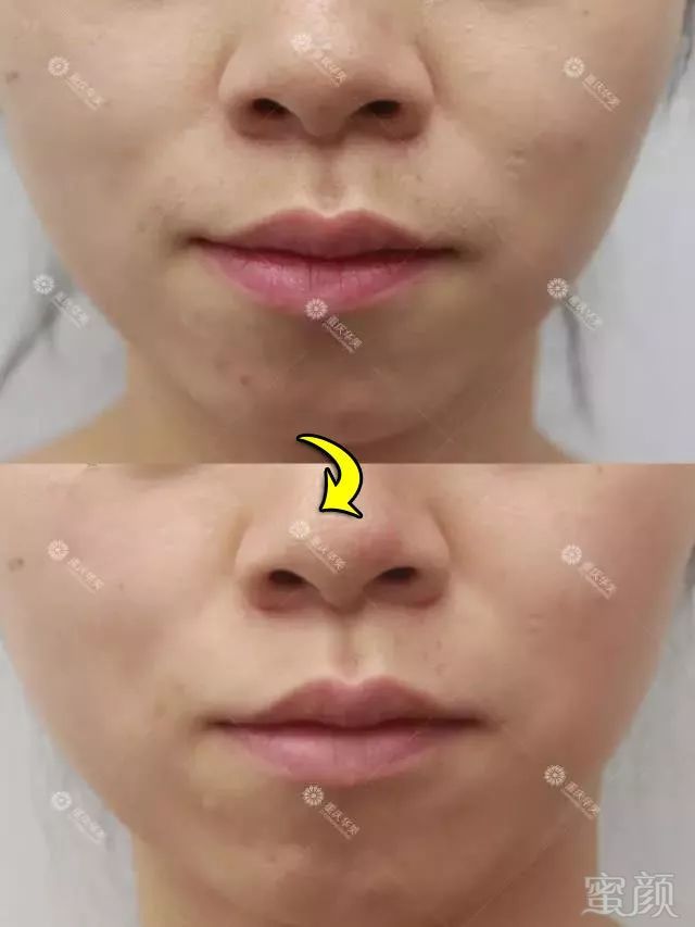 https://img.miyanlife.com/mnt/timg/190203/11260H159-6.jpg