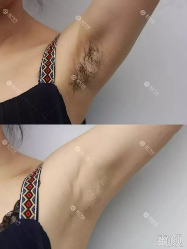 https://img.miyanlife.com/mnt/timg/190203/11260J0Q-5.jpg