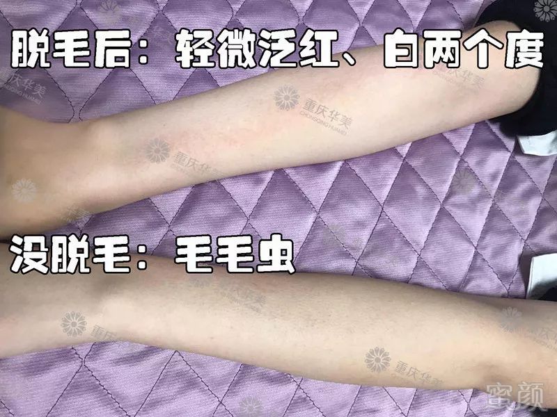 https://img.miyanlife.com/mnt/timg/190203/1126121616-12.jpg