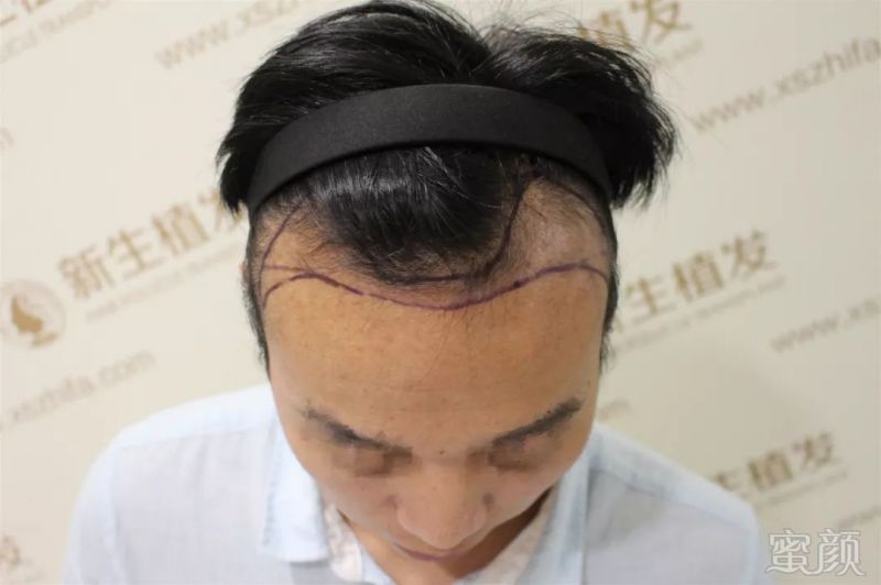 https://img.miyanlife.com/mnt/timg/190203/113G61440-0.jpg