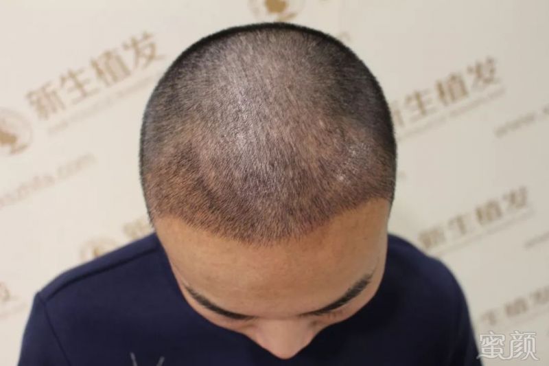 https://img.miyanlife.com/mnt/timg/190203/113GB261-2.jpg