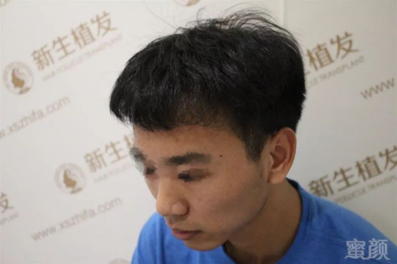 https://img.miyanlife.com/mnt/timg/190203/113GH130-3.jpg