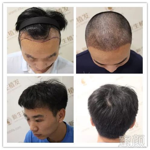 https://img.miyanlife.com/mnt/timg/190203/113GLR8-4.jpg