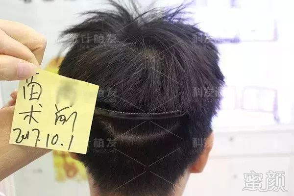 https://img.miyanlife.com/mnt/timg/190203/114520LM-2.jpg