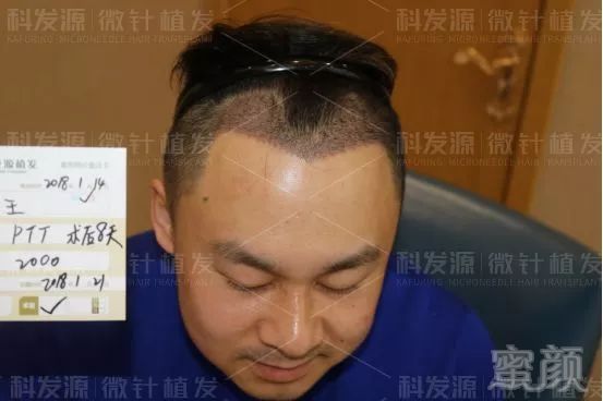 https://img.miyanlife.com/mnt/timg/190203/1145213205-3.jpg