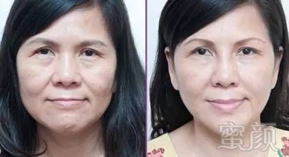 https://img.miyanlife.com/mnt/timg/190204/103H525J-9.jpg