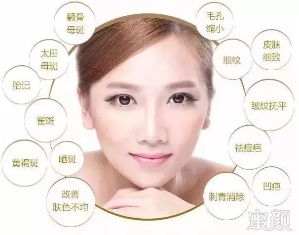 https://img.miyanlife.com/mnt/timg/190204/1040551A1-7.jpg