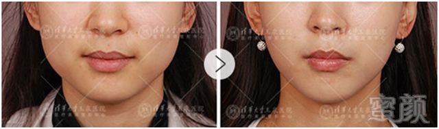 https://img.miyanlife.com/mnt/timg/190204/1044106091-4.jpg