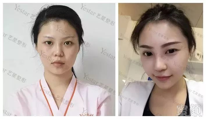 https://img.miyanlife.com/mnt/timg/190204/10464Ra2-10.jpg