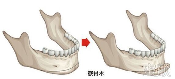 案例图片