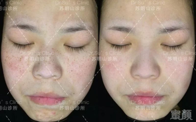 https://img.miyanlife.com/mnt/timg/190204/10543JO6-5.jpg