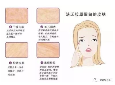 https://img.miyanlife.com/mnt/timg/190204/105535O04-0.jpg
