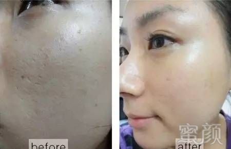 https://img.miyanlife.com/mnt/timg/190204/1056162a6-3.jpg