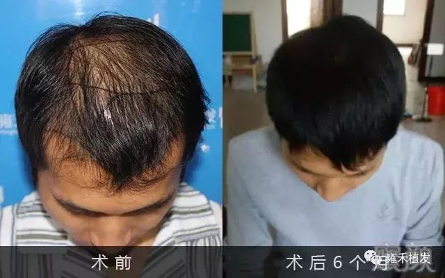 https://img.miyanlife.com/mnt/timg/190204/1114413941-6.jpg