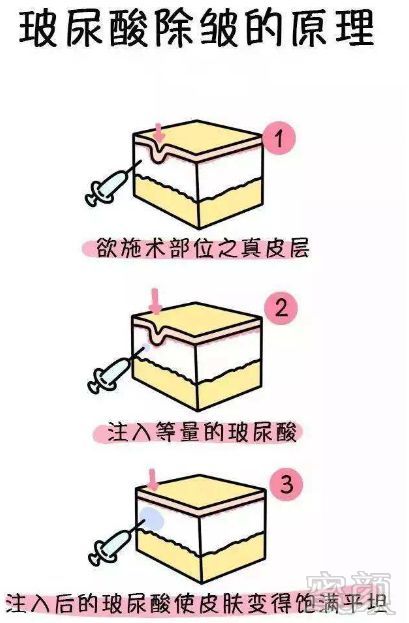 https://img.miyanlife.com/mnt/timg/190205/132Z32a2-14.jpg