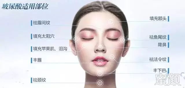 https://img.miyanlife.com/mnt/timg/190205/13501454I-4.jpg