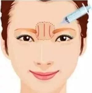 https://img.miyanlife.com/mnt/timg/190207/115G25101-2.jpg