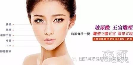 https://img.miyanlife.com/mnt/timg/190207/1209423434-0.jpg