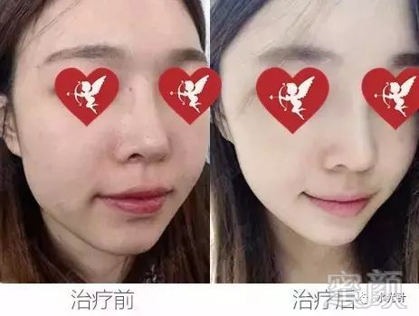 https://img.miyanlife.com/mnt/timg/190207/12150013U-7.jpg