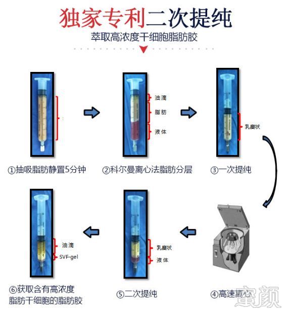 案例图片