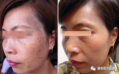 https://img.miyanlife.com/mnt/timg/190209/12261T040-3.jpg