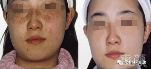 https://img.miyanlife.com/mnt/timg/190209/122620Db-11.jpg