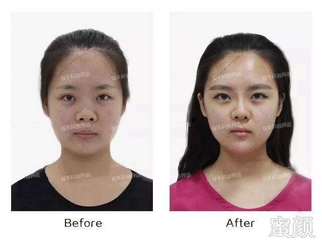 https://img.miyanlife.com/mnt/timg/190210/1123251014-3.jpg