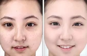 https://img.miyanlife.com/mnt/timg/190210/1322443H0-4.jpg