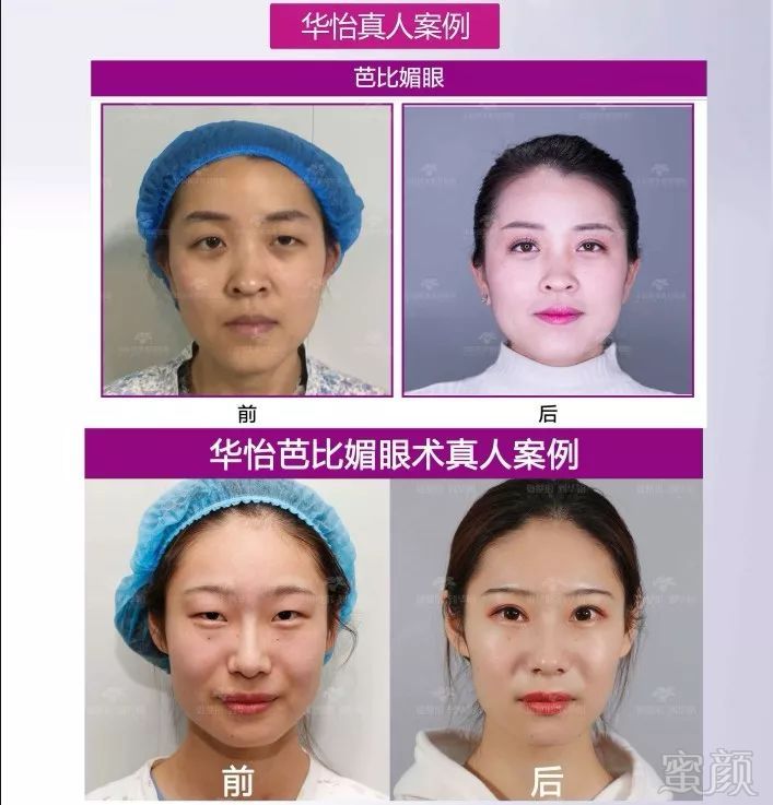 https://img.miyanlife.com/mnt/timg/190211/1303403036-1.jpg
