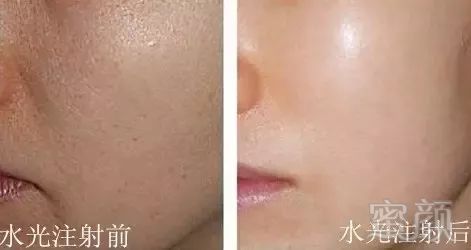 https://img.miyanlife.com/mnt/timg/190211/1303436008-3.jpg