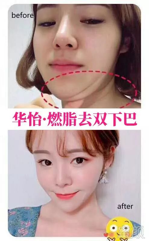 https://img.miyanlife.com/mnt/timg/190211/1303441B3-4.jpg