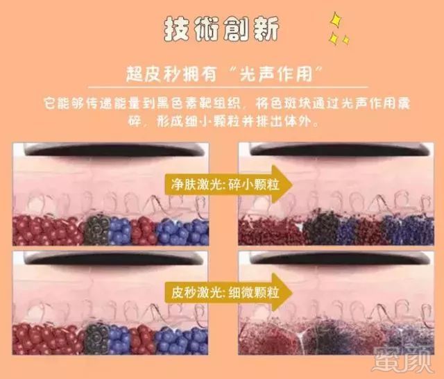 https://img.miyanlife.com/mnt/timg/190212/123A5OE-7.jpg