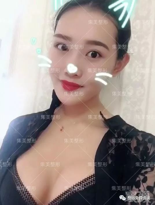 案例图片